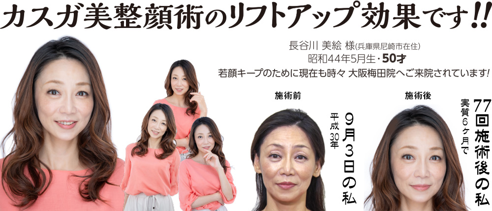 長谷川美絵様(兵庫県尼崎市在住)昭和44年5月生・50才